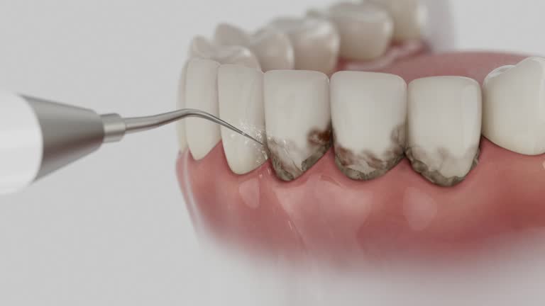 Reliable Wisdom Tooth Removal contractor in Jackson County County, OH by Dentist Open Now